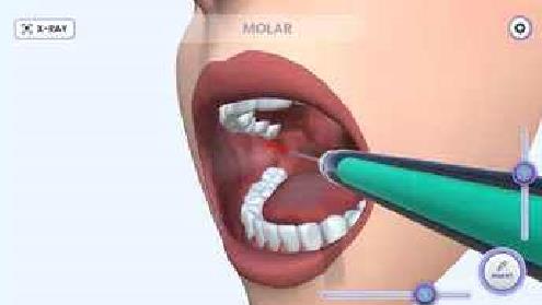 牙医模拟截图(4)
