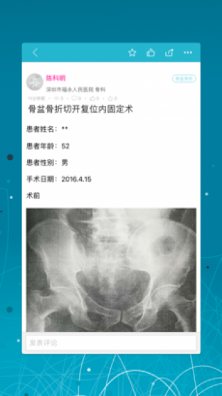 论桥接骨截图(4)